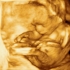 17 tygodni ciąży chłopczyk albo dziewczynka